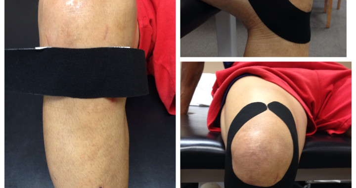 Got Knee Pain? Try This Simple Taping Technique To Ease Your Pain